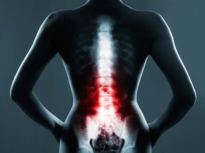 Human spine in x-ray, on gray background. The lumbar spine is highlighted by red colour.